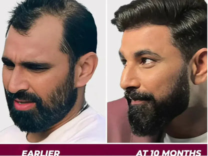 🌿 Jamalgota Ayurvedic Hair Growth Powder Buy 1 Get 1 Free✅